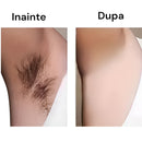 Wiederaufladbarer elektrischer Epilierer für Damen - Fortschrittliche Technologie für professionelle Epilation zu Hause